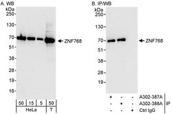 ZNF768 Rabbit anti-Human, Polyclonal, Bethyl Laboratories 100 &mu;L; Unconjugated:Antibodies,