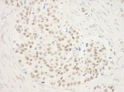 ZNF768 Polyclonal Antibody, Bethyl Laboratories 10 &mu;L; Unconjugated:Antibodies,