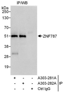 ZNF787 Rabbit anti-Human, Polyclonal, Bethyl Laboratories 100 &mu;L; Unconjugated:Antibodies,