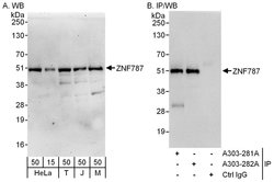 ZNF787 Rabbit anti-Human, Mouse, Polyclonal, Bethyl Laboratories 100 &mu;L | Buy Online | Bethyl Laboratories, Inc | Fisher Scientific