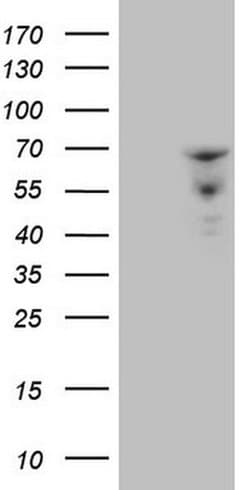 ZNF79 Monoclonal Antibody (OTI3D2), TrueMAB , OriGene 100 &mu;L; Unconjugated:Antibodies,