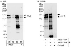 ZO-2 Rabbit anti-Human, Polyclonal, Bethyl Laboratories 100 &mu;L; Unconjugated:Antibodies,