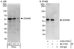 ZONAB Rabbit anti-Human, Polyclonal, Bethyl Laboratories 100 &mu;l; Unlabeled:Antibodies,