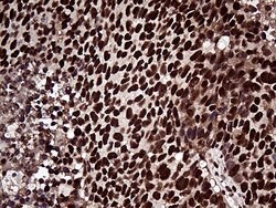 ZRANB2 Monoclonal Antibody (OTI2E3), TrueMAB , OriGene:Antibodies:Primary