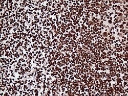 ZRANB2 Monoclonal Antibody (OTI2E3), TrueMAB , OriGene 100 &mu;L; Unconjugated:Antibodies,