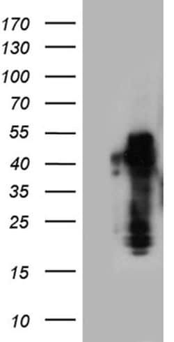 ZRANB2 Mouse anti-Human, Clone: OTI2E3, lyophilized, TrueMAB 100 &mu;g;