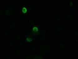 ZSCAN18 Monoclonal Antibody (OTI4B7), TrueMAB , OriGene 100 &mu;L; Unconjugated:Antibodies,