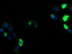 ZSCAN18 Monoclonal Antibody (OTI1F10), TrueMAB , OriGene 100 &mu;L; Unconjugated:Antibodies,