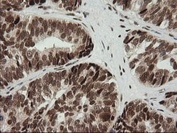 ZSCAN18 Monoclonal Antibody (OTI1F10), TrueMAB , OriGene:Antibodies:Primary