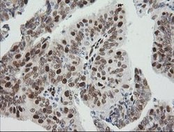 ZSCAN18 Monoclonal Antibody (OTI1F10), TrueMAB , OriGene 100 &mu;L; Unconjugated:Antibodies,
