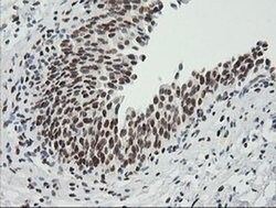ZSCAN18 Monoclonal Antibody (OTI1F10), TrueMAB , OriGene 100 &mu;L; Unconjugated:Antibodies,