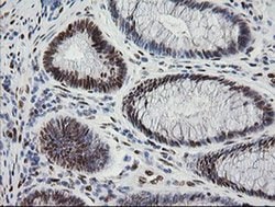 ZSCAN18 Monoclonal Antibody (OTI1F10), TrueMAB , OriGene 100 &mu;L; Unconjugated:Antibodies,