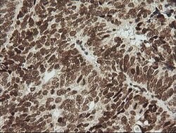ZSCAN18 Monoclonal Antibody (OTI2H7), TrueMAB , OriGene 100 &mu;L; Unconjugated:Antibodies,