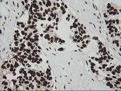 ZSCAN18 Monoclonal Antibody (OTI2H7), TrueMAB , OriGene 100 &mu;L; Unconjugated:Antibodies,