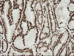 ZSCAN18 Monoclonal Antibody (OTI2H7), TrueMAB , OriGene 100 &mu;L; Unconjugated:Antibodies,