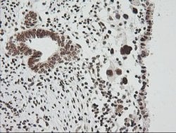 ZSCAN18 Monoclonal Antibody (OTI2H7), TrueMAB , OriGene 100 &mu;L; Unconjugated:Antibodies,