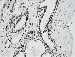 ZSCAN18 Monoclonal Antibody (OTI2H7), TrueMAB , OriGene 100 &mu;L; Unconjugated:Antibodies,