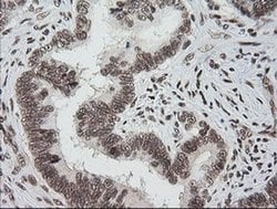 ZSCAN18 Monoclonal Antibody (OTI2H7), TrueMAB , OriGene 100 &mu;L; Unconjugated:Antibodies,