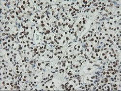ZSCAN18 Monoclonal Antibody (OTI2H7), TrueMAB , OriGene 100 &mu;L; Unconjugated:Antibodies,