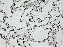 ZSCAN18 Monoclonal Antibody (OTI2H7), TrueMAB , OriGene 100 &mu;L; Unconjugated:Antibodies,