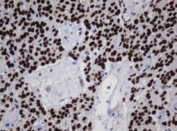 ZSCAN18 Monoclonal Antibody (OTI2A9), TrueMAB , OriGene 30 &mu;L; Unconjugated:Antibodies,