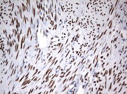ZSCAN18 Mouse anti-Human, Clone: UMAB114, liquid, UltraMAB 30 &mu;L; Unconjugated:Antibodies,
