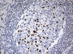 ZSCAN18 Mouse anti-Human, Clone: UMAB114, liquid, UltraMAB 30 &mu;L; Unconjugated:Antibodies,