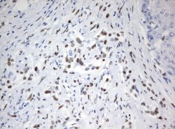 ZSCAN18 Mouse anti-Human, Clone: UMAB114, liquid, UltraMAB 30 &mu;L; Unconjugated:Antibodies,
