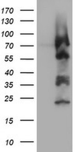 ZSCAN18 Monoclonal Antibody (OTI2D3), TrueMAB , OriGene 30 &mu;L; Unconjugated:Antibodies,