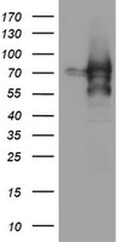 ZSCAN18 Monoclonal Antibody (OTI4B7), TrueMAB , OriGene:Antibodies:Primary