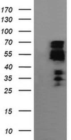 ZSCAN18 Monoclonal Antibody (OTI1F10), TrueMAB , OriGene:Antibodies:Primary