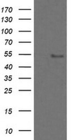ZSCAN18 Monoclonal Antibody (OTI2H7), TrueMAB , OriGene 100 &mu;L; Unconjugated:Antibodies,