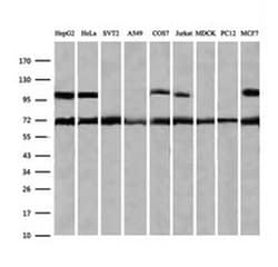ZSCAN18 Monoclonal Antibody (OTI2H7), TrueMAB , OriGene 100 &mu;L; Unconjugated:Antibodies,