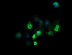 ZSCAN21 Monoclonal Antibody (OTI2E5), TrueMAB , OriGene 100 &mu;L; Unconjugated:Antibodies,