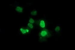 ZSCAN21 Monoclonal Antibody (OTI3D4), TrueMAB , OriGene 100 &mu;L; Unconjugated:Antibodies,