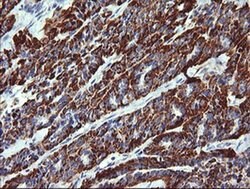 ZSCAN21 Monoclonal Antibody (OTI2E5), TrueMAB , OriGene:Antibodies:Primary