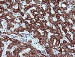 ZSCAN21 Monoclonal Antibody (OTI2E5), TrueMAB , OriGene 100 &mu;L; Unconjugated:Antibodies,