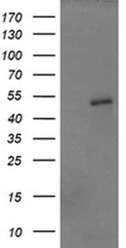 ZSCAN21 Monoclonal Antibody (OTI2E3), TrueMAB , OriGene 100 &mu;L; Unconjugated:Antibodies,