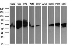 ZSCAN21 Monoclonal Antibody (OTI2E3), TrueMAB , OriGene 100 &mu;L; Unconjugated:Antibodies,