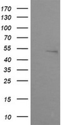 ZSCAN21 Monoclonal Antibody (OTI2E5), TrueMAB , OriGene:Antibodies:Primary