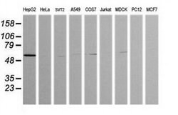 ZSCAN21 Monoclonal Antibody (OTI2E5), TrueMAB , OriGene 100 &mu;L; Unconjugated:Antibodies,