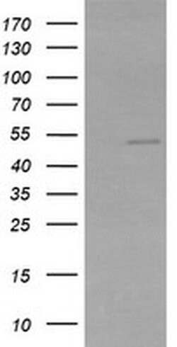 ZSCAN21 Monoclonal Antibody (OTI2F5), TrueMAB , OriGene:Antibodies:Primary