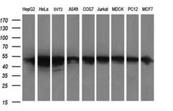 ZSCAN21 Monoclonal Antibody (OTI2F5), TrueMAB , OriGene 100 &mu;L; Unconjugated:Antibodies,