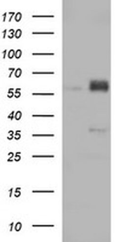 ZSCAN21 Monoclonal Antibody (OTI3D4), TrueMAB , OriGene 100 &mu;L; Unconjugated:Antibodies,