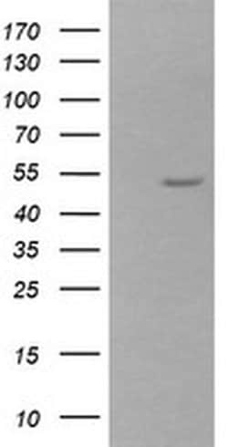ZSCAN21 Monoclonal Antibody (OTI3B3), TrueMAB , OriGene 100 &mu;L; Unconjugated:Antibodies,