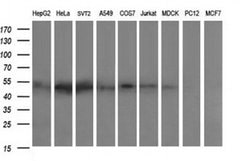 ZSCAN21 Monoclonal Antibody (OTI3B3), TrueMAB , OriGene:Antibodies:Primary