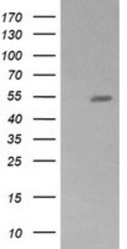 ZSCAN21 Mouse anti-Human, Clone: OTI2D8, lyophilized, TrueMAB 100 &mu;g;