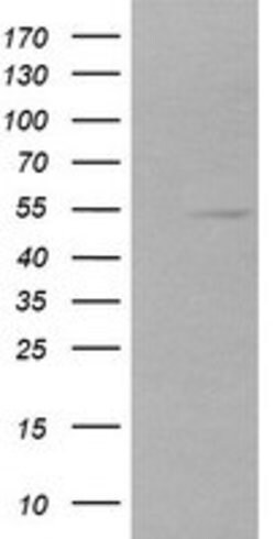 ZSCAN21 Mouse anti-Canine, Human, Rat, Clone: OTI1H7, lyophilized, TrueMAB