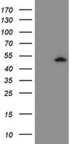 ZSCAN4 Monoclonal Antibody (OTI5A5), TrueMAB , OriGene:Antibodies:Primary