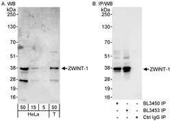 ZWINT-1 Rabbit anti-Human, Polyclonal, Bethyl Laboratories 100 &mu;l; Unlabeled:Antibodies,